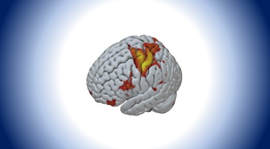 2PY404-201<span class="highlight">9</span>-20-SEM2 2PY404 | Advanced Topics in Brain and Behaviour | 201<span class="highlight">9</span>-20 SEM2