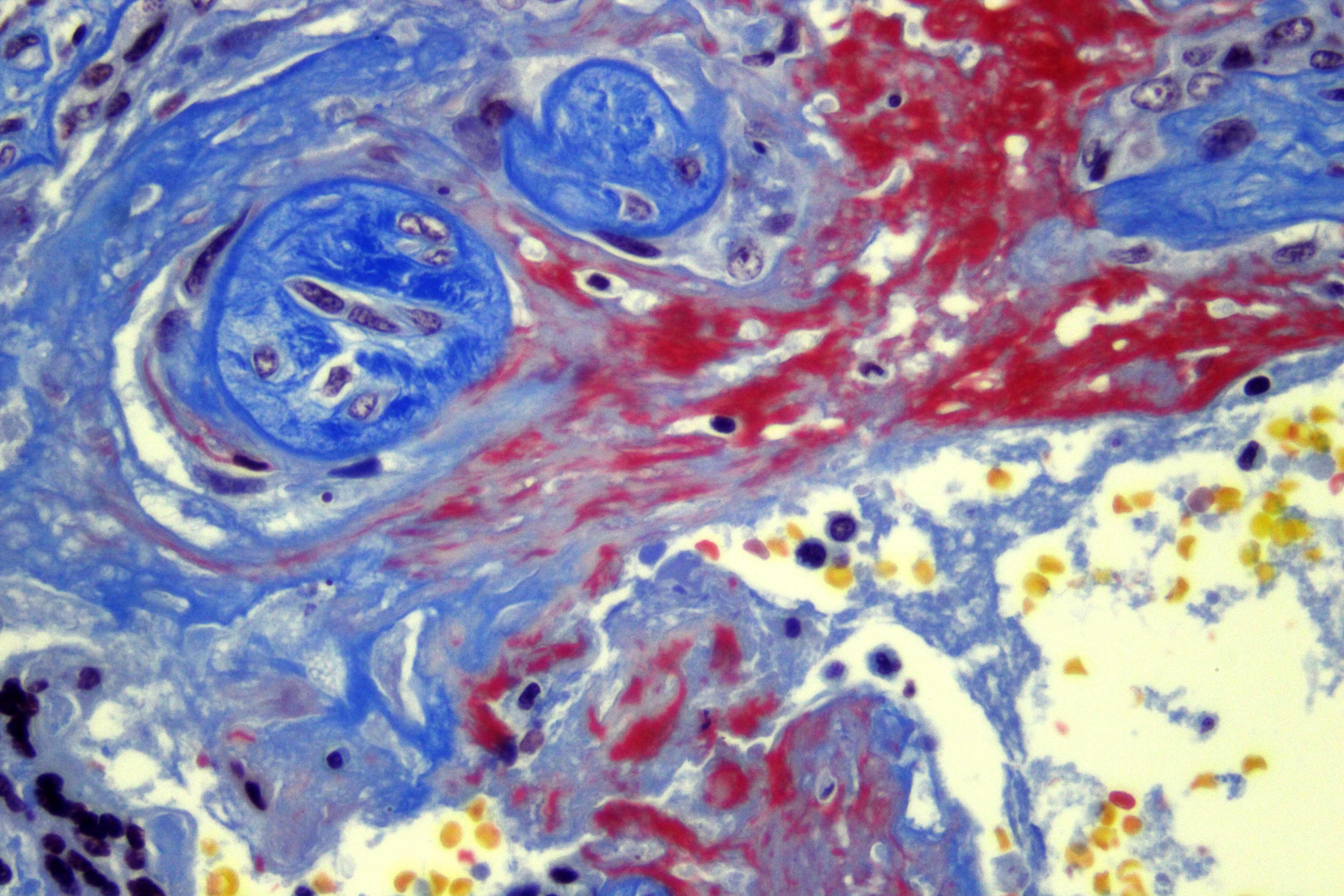 BIO5018M | Cellular Pathology | 2025-26 SEM2 (Group A)